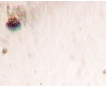 ParaZapper Protozoa killed